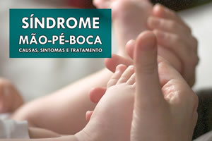 Surto Da Síndrome Mão - Pé - Boca, pais vocês Sabem o que é?