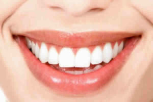 Veja como ter um sorriso mais bonito com o plano dental!